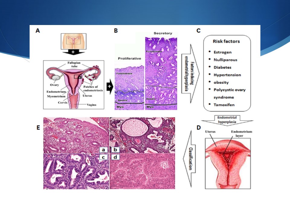 20181010 Breast Cancer ASS talk 1