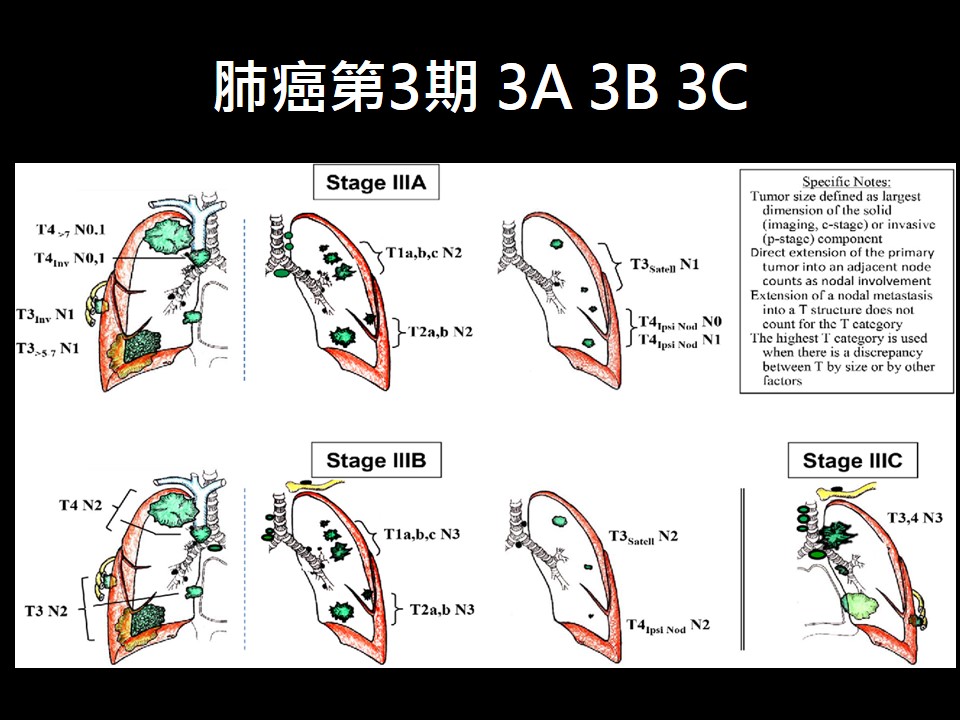 20181117 第3版 看當今免疫治療如何翻轉肺癌第 1