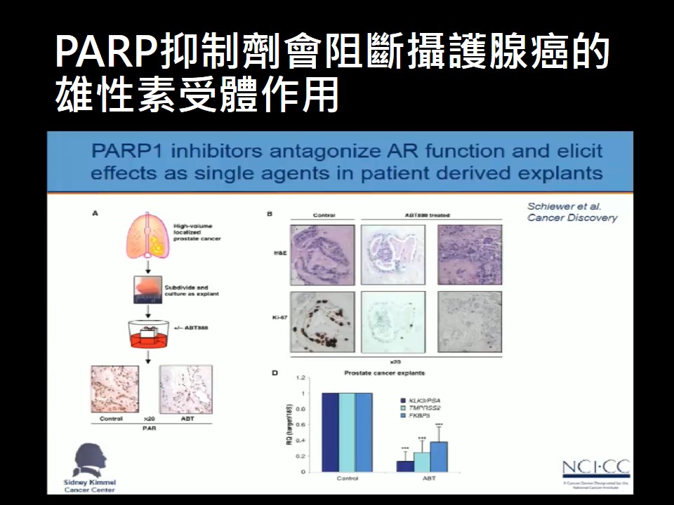 20190309 精準醫療再進化 攝護腺癌治療新進展PARP抑制劑