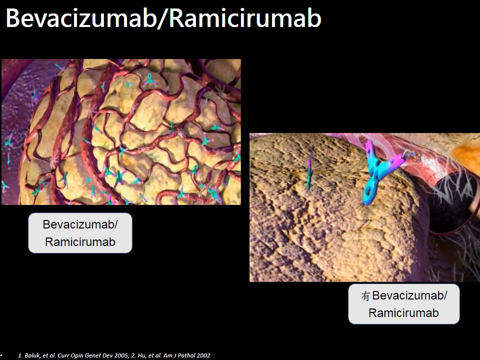 20190427 抗血管標靶治療新進展