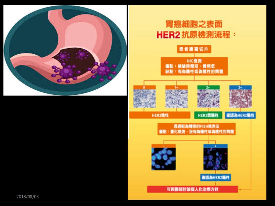 20190921 陳駿逸 基因檢測協助大腸 3