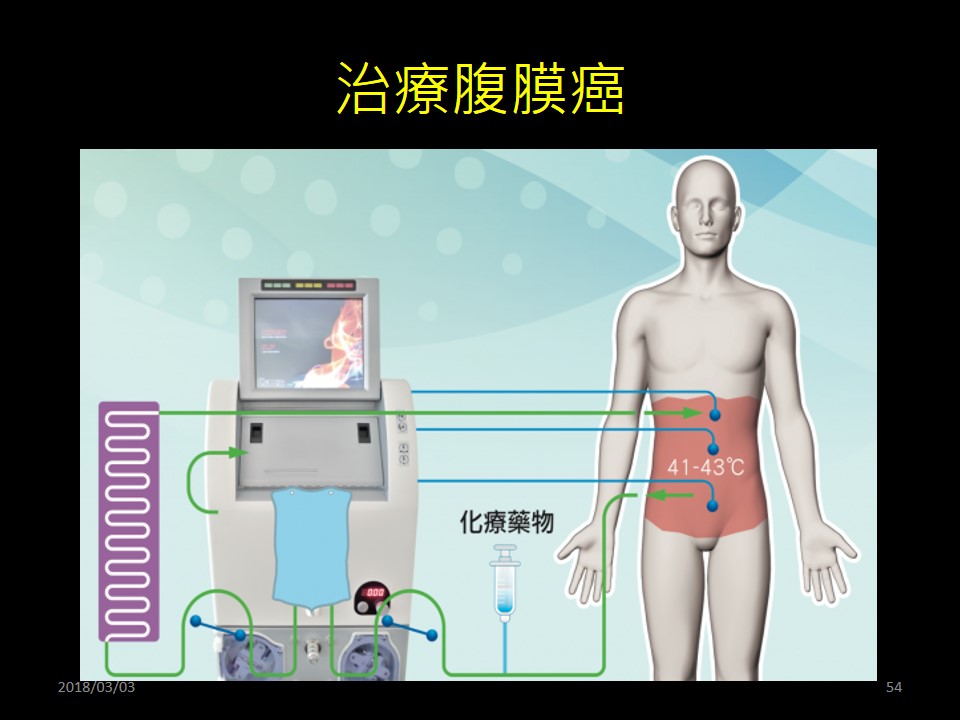 20190921 陳駿逸 認識癌症溫熱療法 2