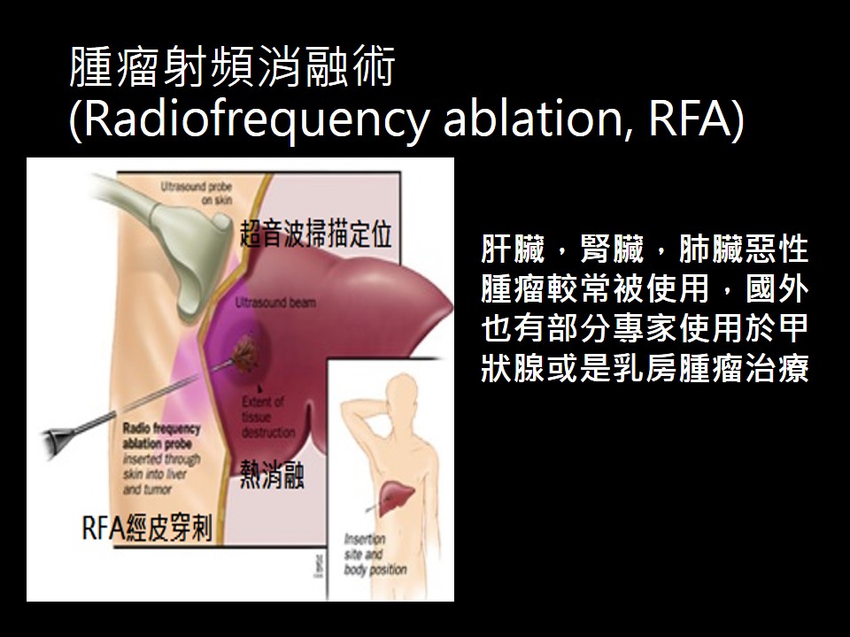 20190921 陳駿逸 認識癌症溫熱療法