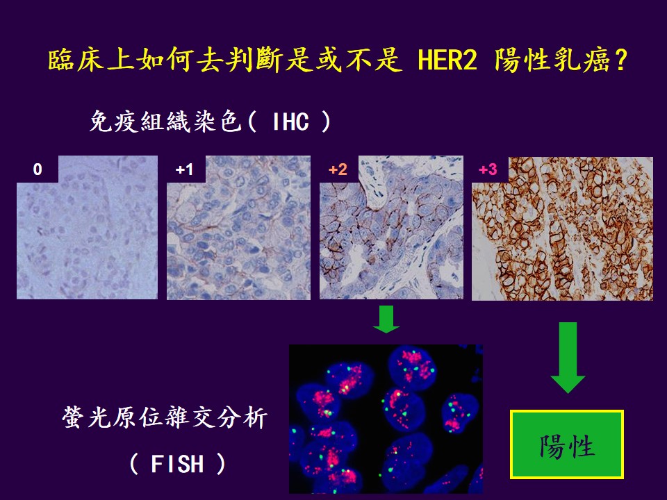 HER 2乳癌如何使用標靶治療7