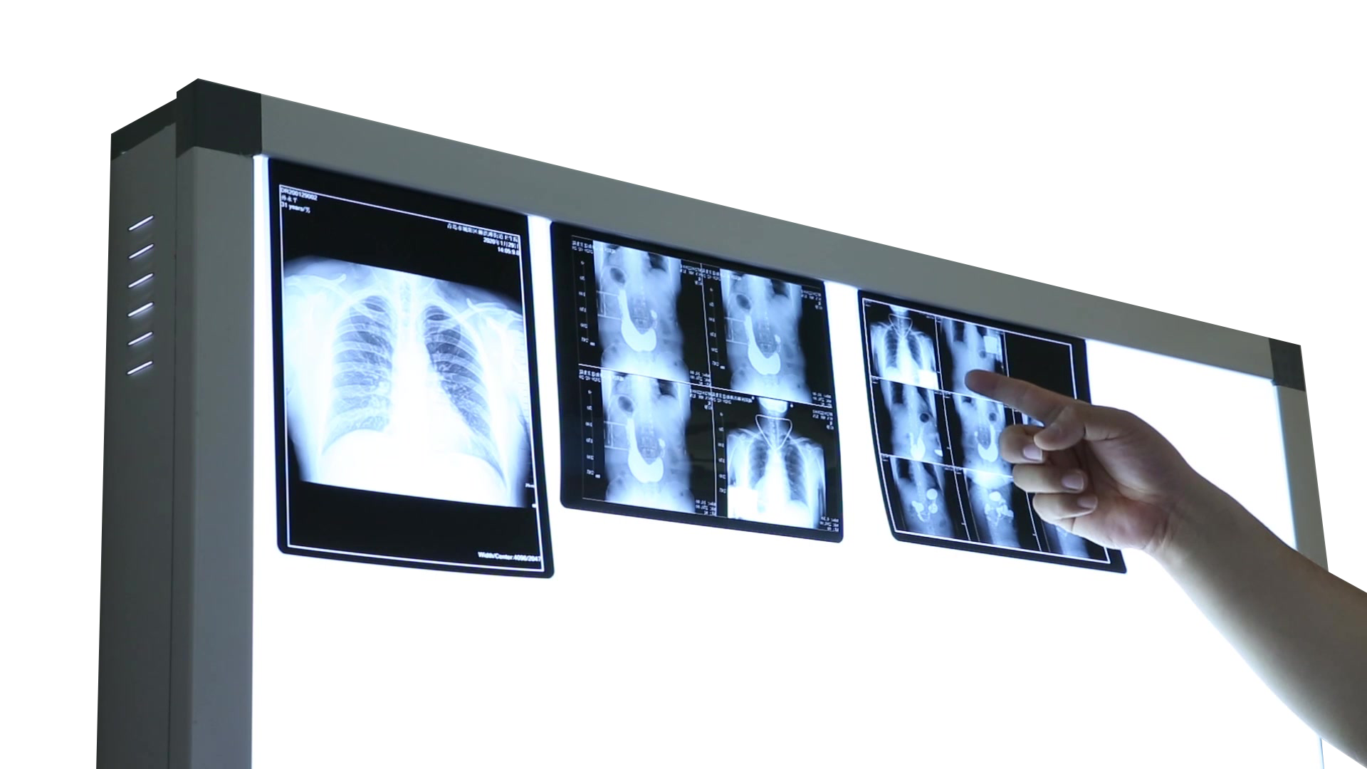 Pngtreedoctor examining x ray 6740306