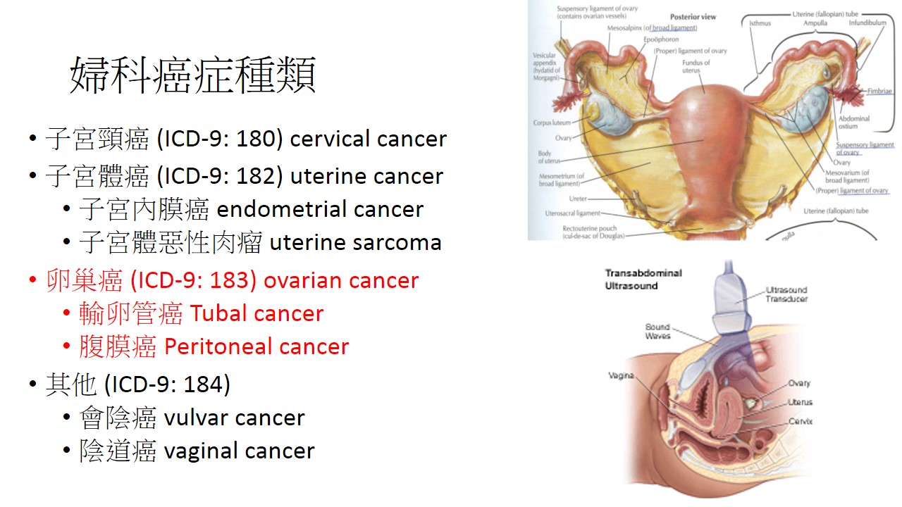 卵巢癌診治面面觀 1