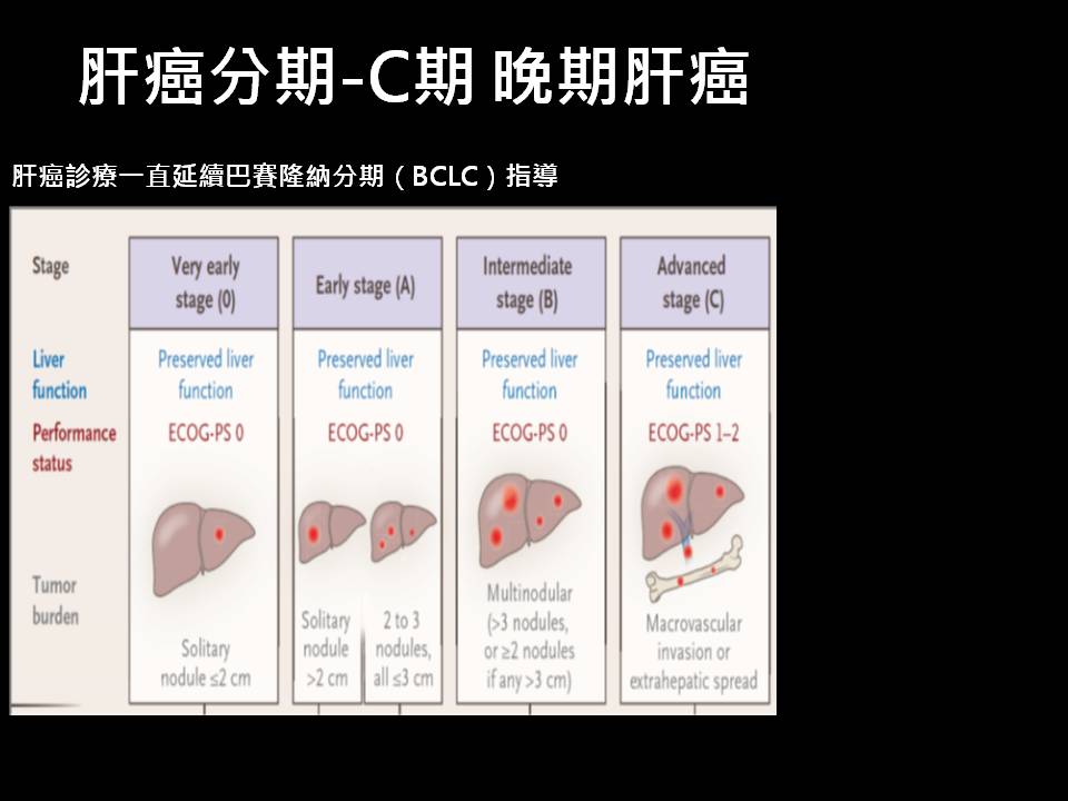 肝癌治療簡介16