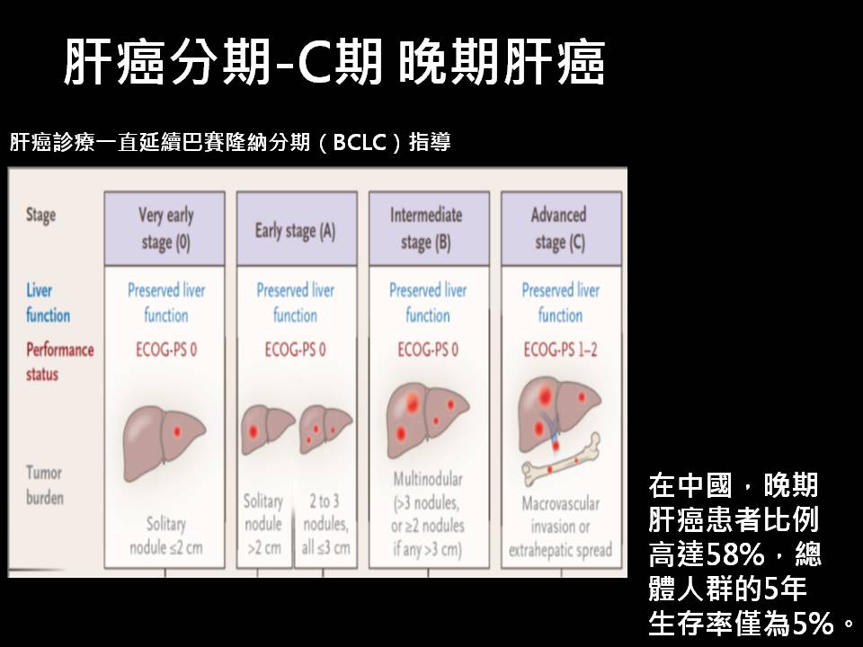 肝癌治療簡介17